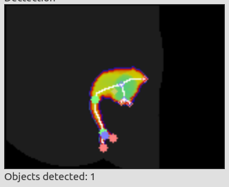 Person overlaid with skeleton, skeleton key points belonging to extremities are filled